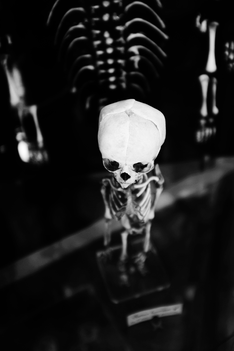 Foetal Skeletons by Laurent Orseau #1