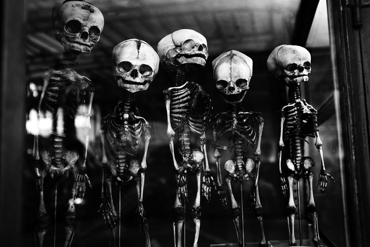 Foetal Skeletons by Laurent Orseau #10