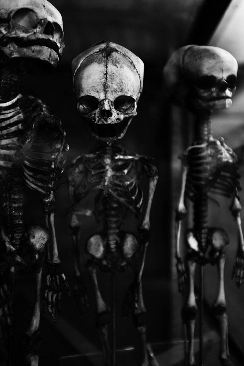Foetal Skeletons by Laurent Orseau #6
