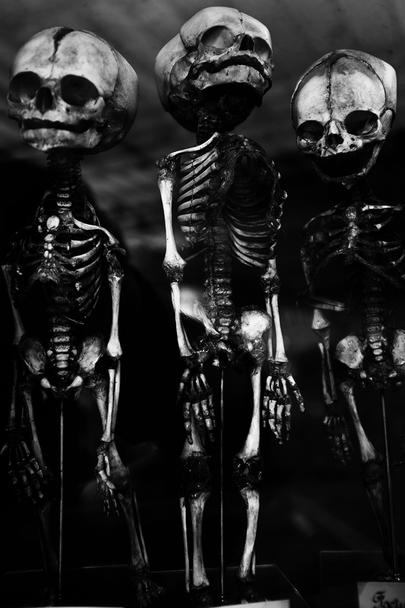 Foetal Skeletons by Laurent Orseau #7